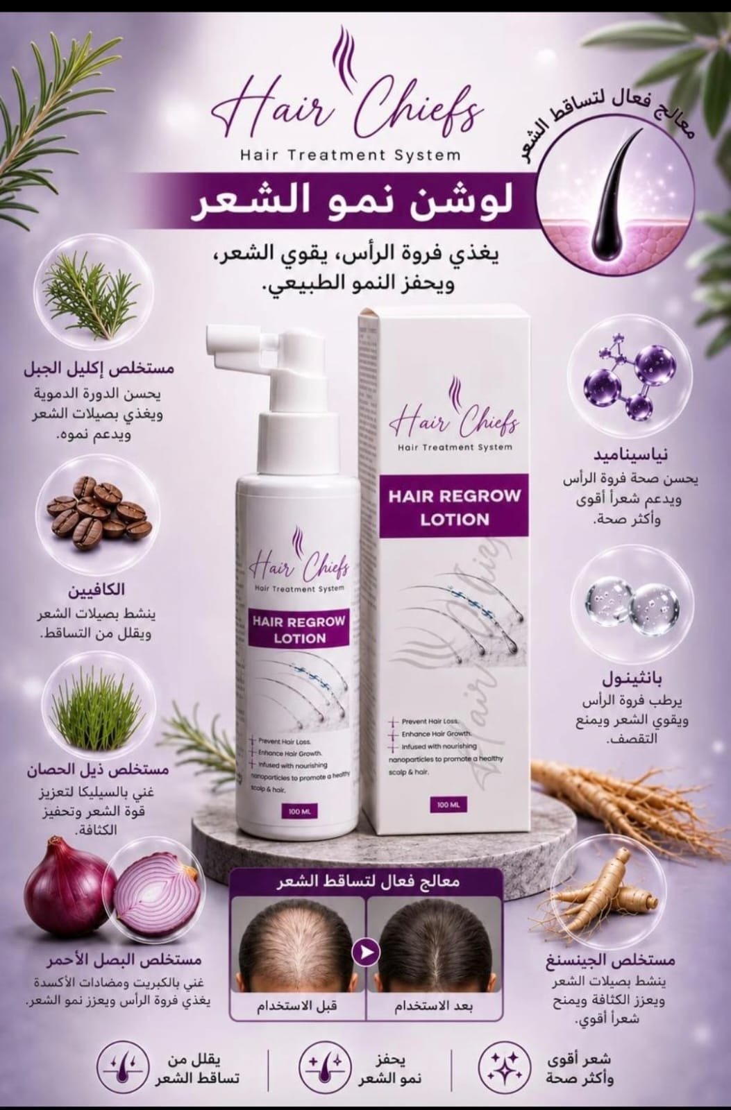 لوشن هيرشيفز لايقاف التساقط